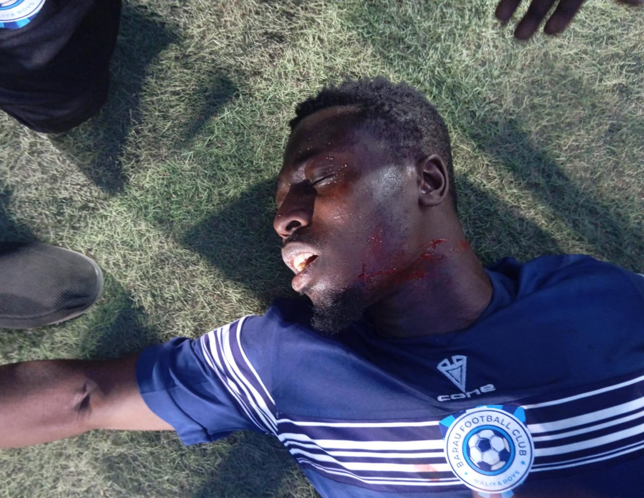 Image of an injured Nana Abraham during Katsina United vs Barau FC clash
