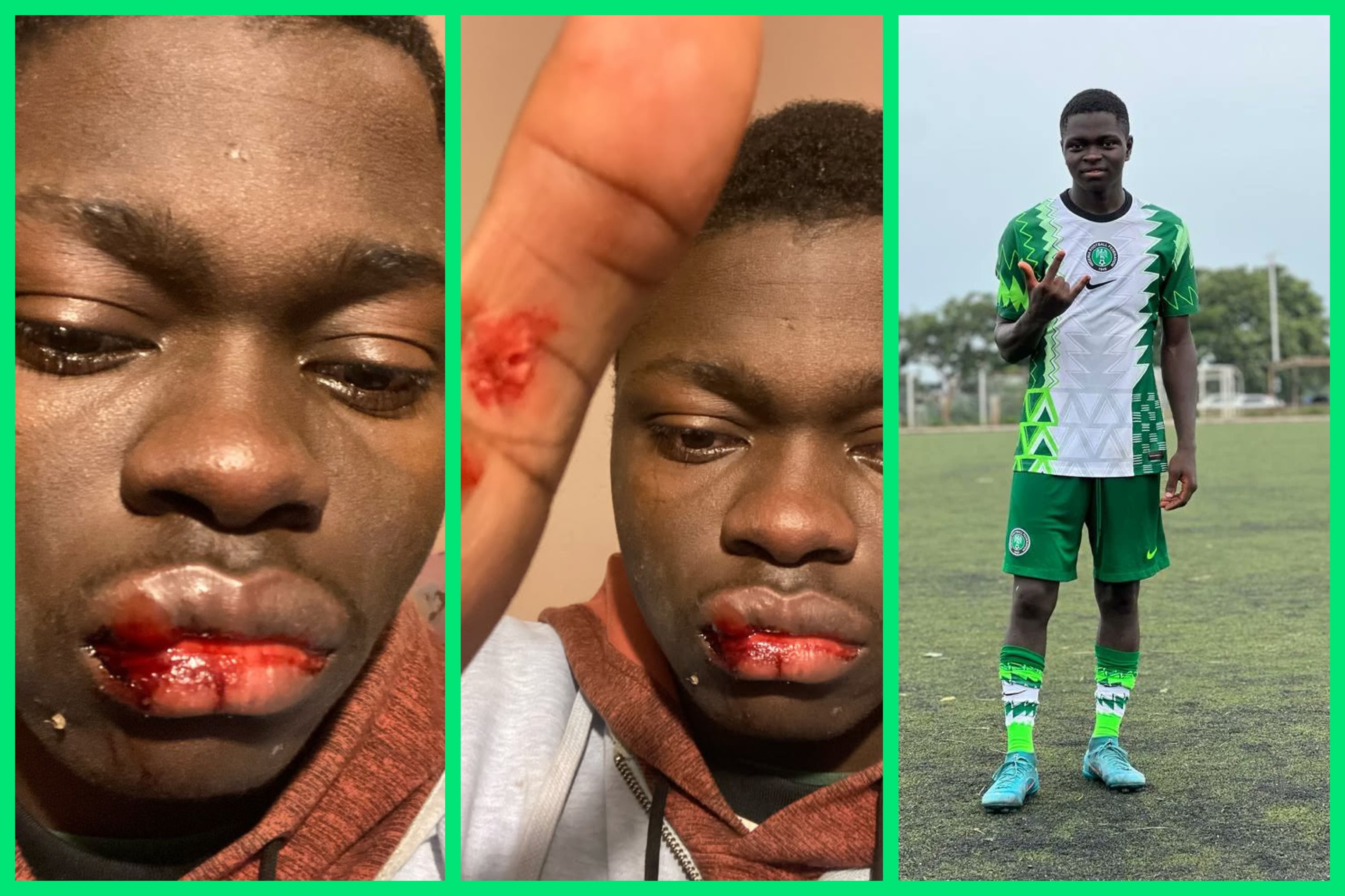 Like Didier Drogba warned, Nigerian starlet Moses Jerry beaten by fake Serbian football agent — The Full story